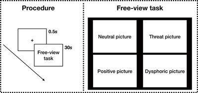 Trait anxiety affects attentional bias to emotional stimuli across time: A growth curve analysis